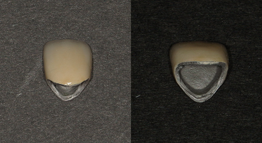 ハイブリッドセラミック